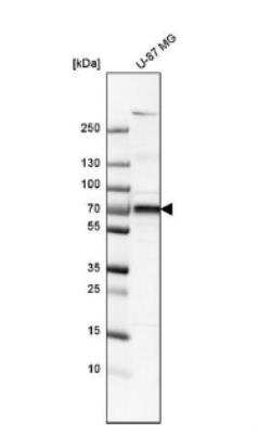 Western Blot: 5'-Nucleotidase/CD73 Antibody [NBP1-85740]