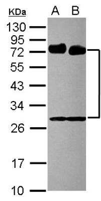Western Blot: 5'-Nucleotidase/CD73 Antibody [NBP2-15815]