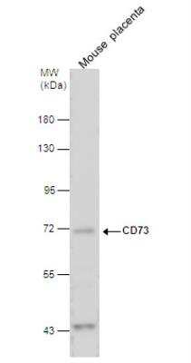 Western Blot: 5'-Nucleotidase/CD73 Antibody [NBP2-15815]