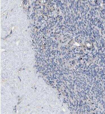 Immunohistochemistry-Paraffin: 5-HT1A Antibody [NBP1-90321]