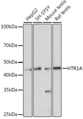 Western Blot: 5-HT1A AntibodyAzide and BSA Free [NBP3-03099]