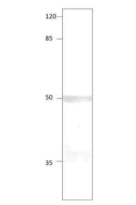 Western Blot: 5-HT1A Antibody [NBP3-12374]