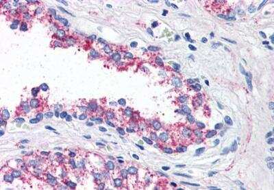 Immunohistochemistry-Paraffin: 5-HT1B Antibody - BSA Free [NBP3-06662]