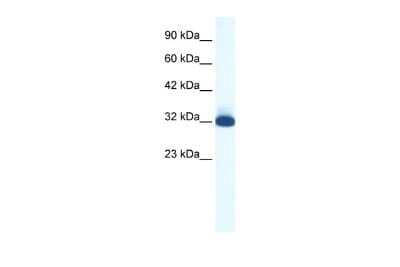 Western Blot: 5-HT1B Antibody [NBP2-86927]