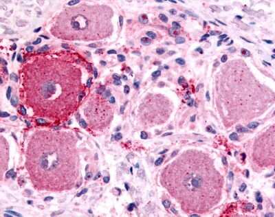 Immunohistochemistry-Paraffin: 5-HT1D Antibody - BSA Free [NLS590]