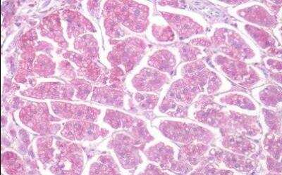 Immunohistochemistry-Paraffin: 5-HT1D Antibody - BSA Free [NLS590]