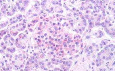 Immunohistochemistry-Paraffin: 5-HT1D Antibody - BSA Free [NLS590]