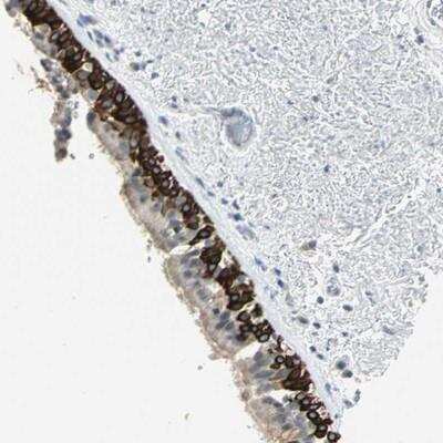 Immunohistochemistry: 5-HT1F Antibody [NBP1-90319]