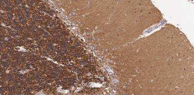 Immunohistochemistry-Paraffin: 5-HT2A Antibody [NBP2-26091]