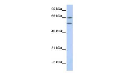 Western Blot: 5-HT2A Antibody [NBP2-86929]