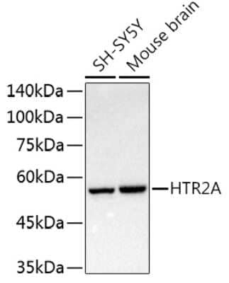 Western Blot: 5-HT2A AntibodyAzide and BSA Free [NBP3-16043]