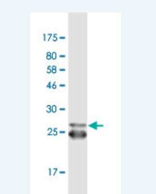 Western Blot: 5-HT2B Antibody (4A4) [H00003357-M01-100ug]