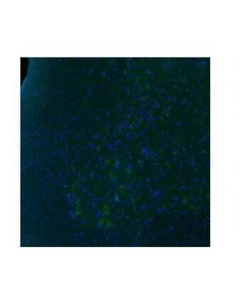 Immunocytochemistry/ Immunofluorescence: 5-HT2B Antibody [NBP1-55429]