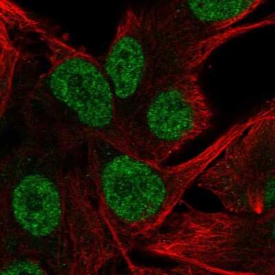 Immunocytochemistry/ Immunofluorescence: 5-HT2B Antibody [NBP2-57832]