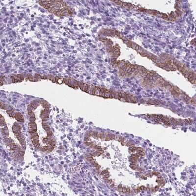 Immunohistochemistry-Paraffin: 5-HT2B Antibody [NBP1-90322]