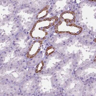 Immunohistochemistry-Paraffin: 5-HT2B Antibody [NBP1-90322]