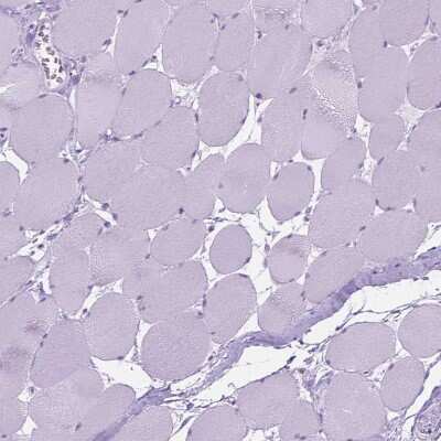 Immunohistochemistry-Paraffin: 5-HT2B Antibody [NBP1-90322]