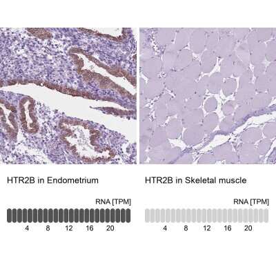 Immunohistochemistry-Paraffin: 5-HT2B Antibody [NBP1-90322]