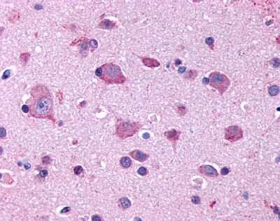 Immunohistochemistry-Paraffin: 5-HT2B Antibody - BSA Free [NLS1111]