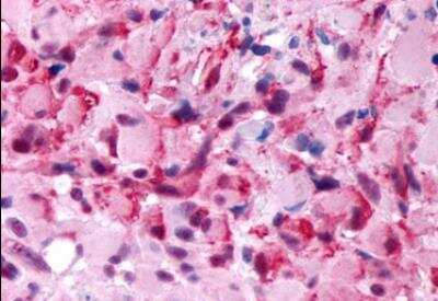 Immunohistochemistry-Paraffin: 5-HT2B Antibody - BSA Free [NLS1111]