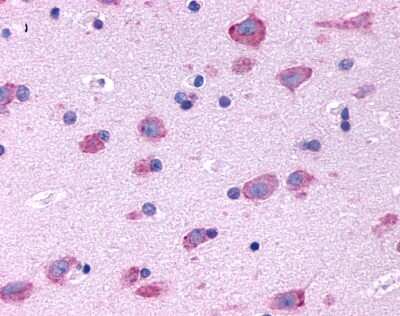 Immunohistochemistry-Paraffin: 5-HT2B Antibody - BSA Free [NLS1187]