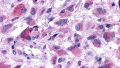 Immunohistochemistry-Paraffin: 5-HT2B Antibody - BSA Free [NLS1187]