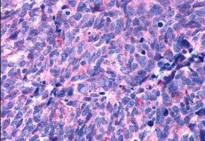 Immunohistochemistry-Paraffin: 5-HT2B Antibody - BSA Free [NLS1187]