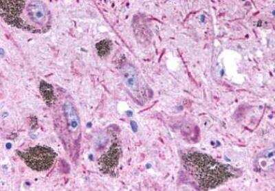 Immunohistochemistry-Paraffin: 5-HT2B Antibody - BSA Free [NLS1187]