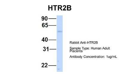 Western Blot: 5-HT2B Antibody [NBP1-55429]