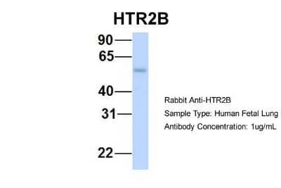 Western Blot: 5-HT2B Antibody [NBP1-55429]