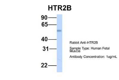 Western Blot: 5-HT2B Antibody [NBP1-55429]