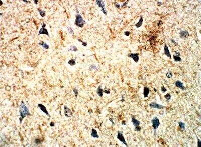 Immunohistochemistry-Paraffin: 5-HT2C Antibody [NBP3-12279]