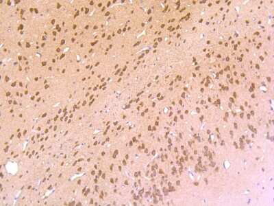 Immunohistochemistry-Paraffin: 5-HT2C Antibody (JA31-31) [NBP2-67100]