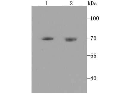 Western Blot: 5-HT2C Antibody (JA31-31) [NBP2-67100]