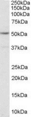 Western Blot: 5-HT2C Antibody [NB100-1524]