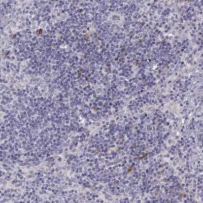 Immunohistochemistry: 5-HT3A Antibody [NBP2-68884]