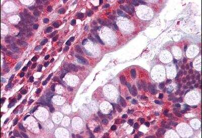 Immunohistochemistry-Paraffin: 5-HT3A Antibody [NB100-41382]