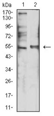 Western Blot: 5-HT3B Antibody (2H9H5)BSA Free [NBP2-61787]