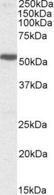 Western Blot: 5-HT3B Antibody [NBP1-51969]