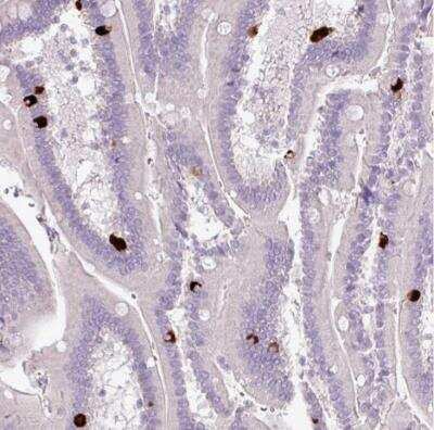 Immunohistochemistry-Paraffin: 5-HT3E Antibody [NBP2-33578]