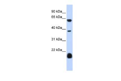 Western Blot: 5-HT3E Antibody [NBP2-82540]