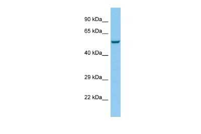 Western Blot: 5-HT3E Antibody [NBP2-82541]