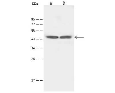 Western Blot: 5-HT4 Antibody [NBP2-99479]