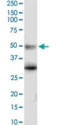 Western Blot: 5-HT5A Antibody (3D1) [H00003361-M02]