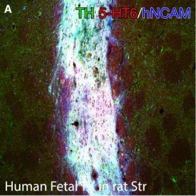 Immunohistochemistry: 5-HT6 Antibody [NBP1-46557]