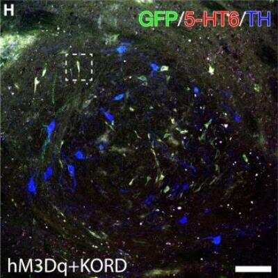 Immunohistochemistry: 5-HT6 Antibody [NBP1-46557]