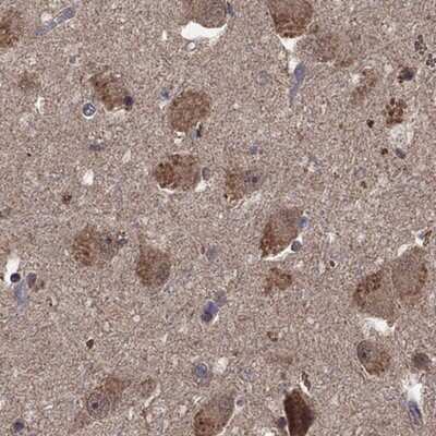 Immunohistochemistry-Paraffin: 5-HT6 Antibody [NBP3-17679]