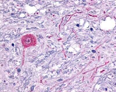 Immunohistochemistry-Paraffin: 5-HT6 Antibody - BSA Free [NLS652]