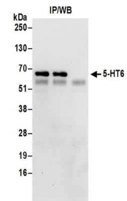 Immunoprecipitation: 5-HT6 Antibody [NBP2-32079]