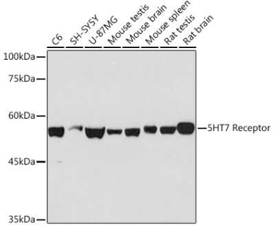 Western Blot: 5-HT7 Antibody (4E6D2) [NBP3-15870]